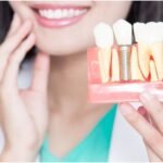 How Dental Implants Can Transform Your Smile and Confidence