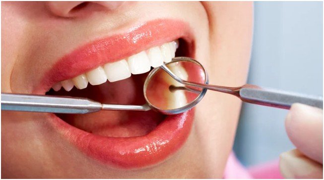Managing Other Common Dental Issues