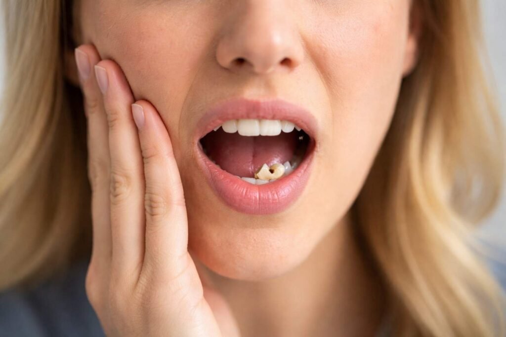 A Cracked Or Broken Tooth