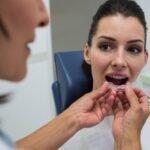 Why Are Clear Braces Gaining Popularity Among Adults in Kelowna